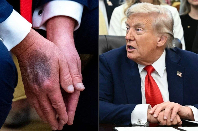 В сети распространяются слухи о смерти Трампа